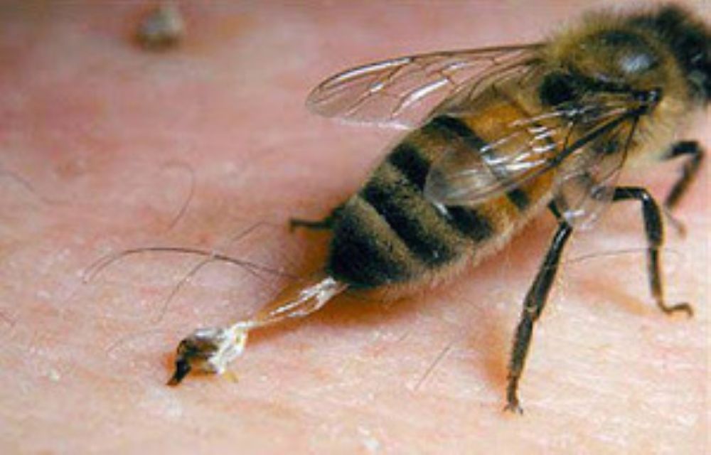 كيف تعالج لسعات النحل معلومات قد تنقذ الارواح