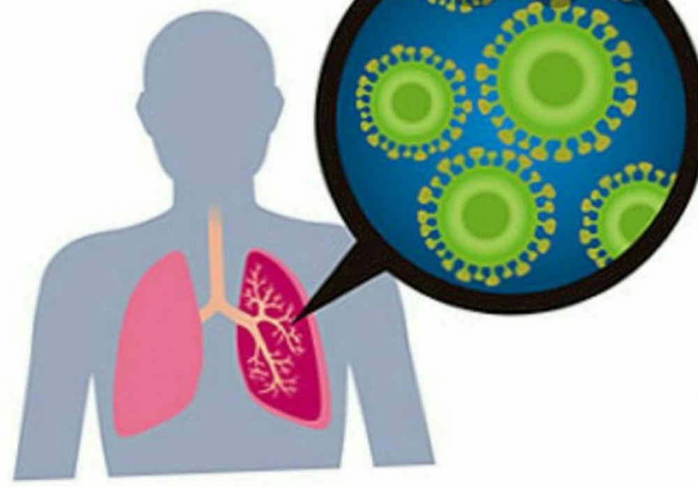 متلامة الشرق الاوسط التنفسية احدى الامراض التي تسببها فيروسات كورونا .